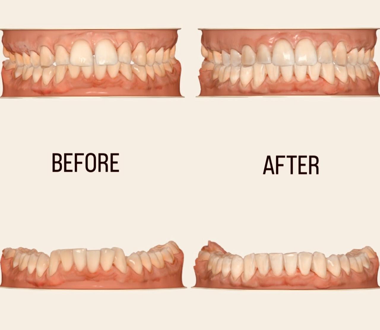 Before & After
